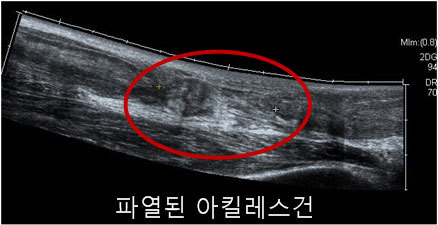 이미지명